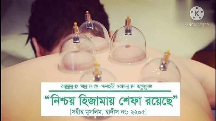 hijama therapy, cupping therapy in Dhaka)