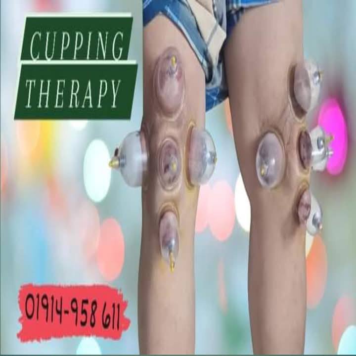Effective cupping therapy session for knee joint pain relief in Dhaka.